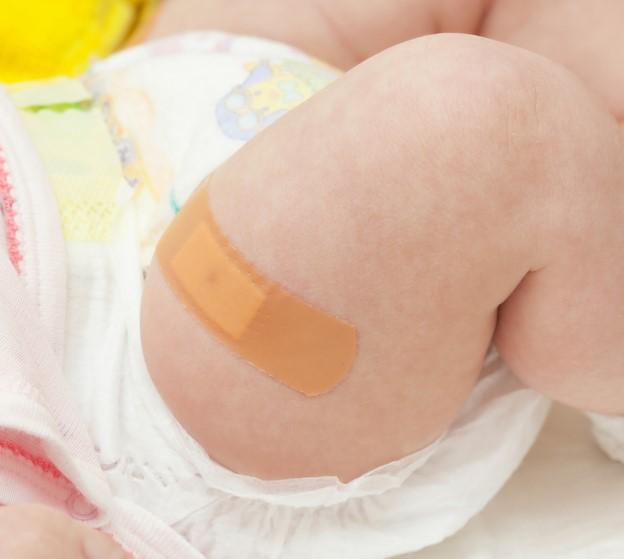Post-vaccine baby thigh