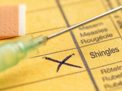 shingles