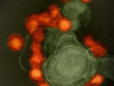 Zika virus