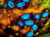 mpox blue brown